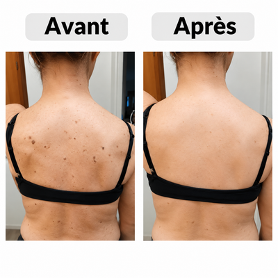 Stick Exfoliant Corps à l’Acide Glycolique